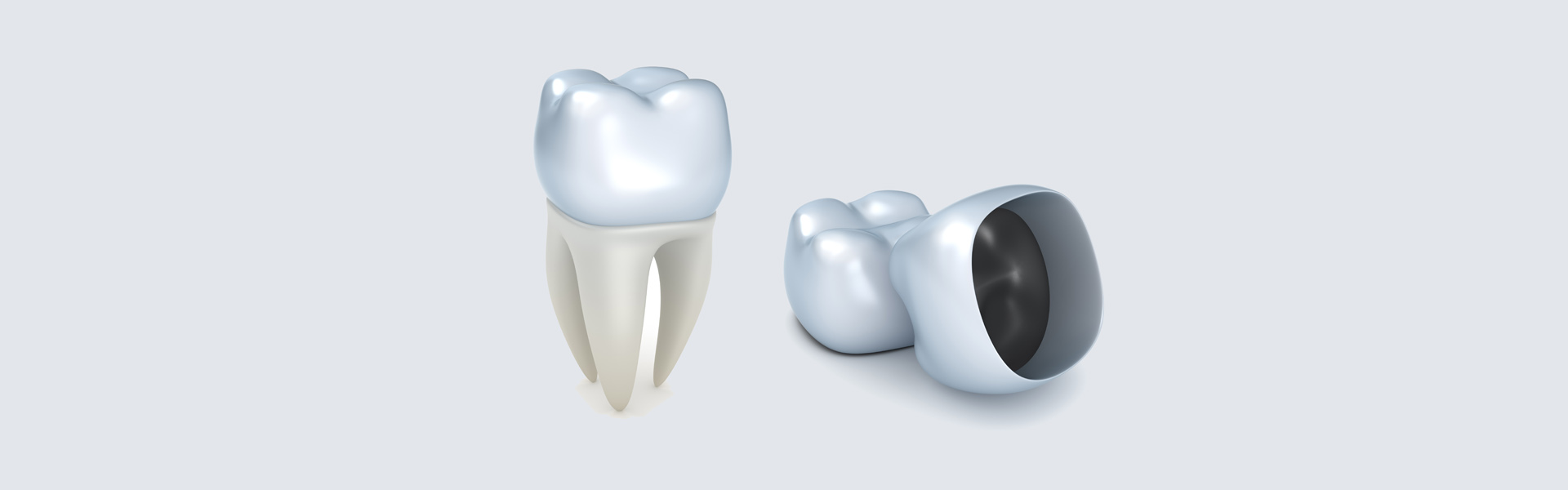 Detailing the Advantages of Dental Crowns