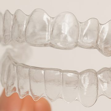 What Are the Advantages of Invisalign for Teeth Straightening?
